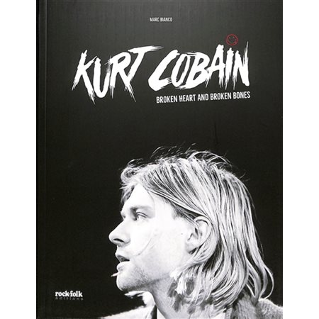 Kurt Cobain : broken heart and broken bones
